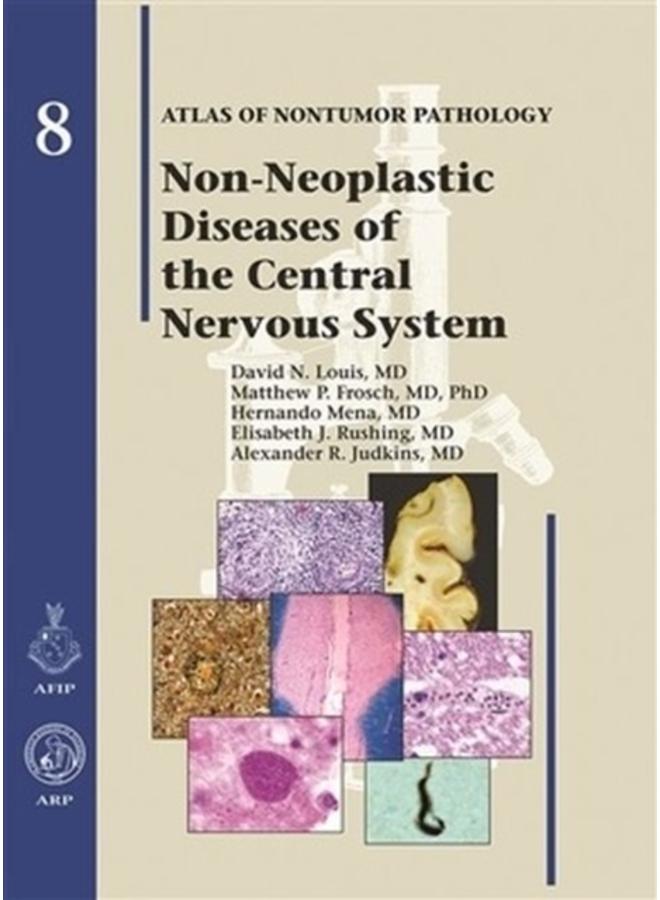Non-Neoplastic Diseases of the Central Nervous System : No 8 