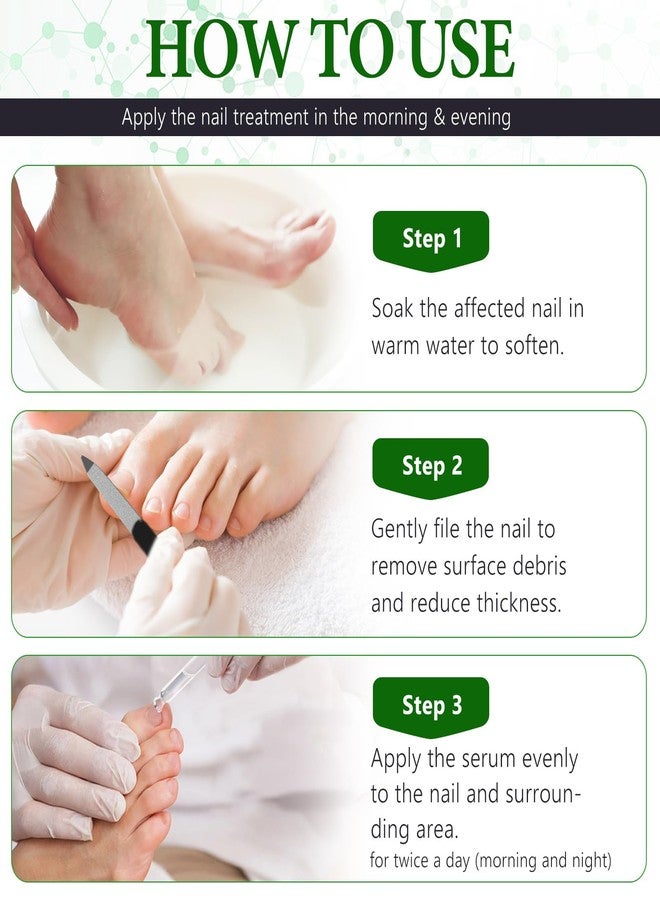 OMZOK 7 Days Nail Fungus Treatment Extra Strength, Toe Nail Growth Oil, Ginger Nail Growth Serum, Foot Toenail Serum for Brittle Thin Damaged Nails Strengther and Growth, Repairs Cuticles - 2 Pcs 1 Pack - Image 4