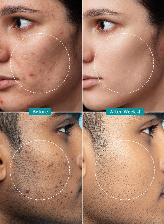 PILGRIM Alpha Arbutin & Vitamin C Brightening Face Serum (Sample) - Image 5