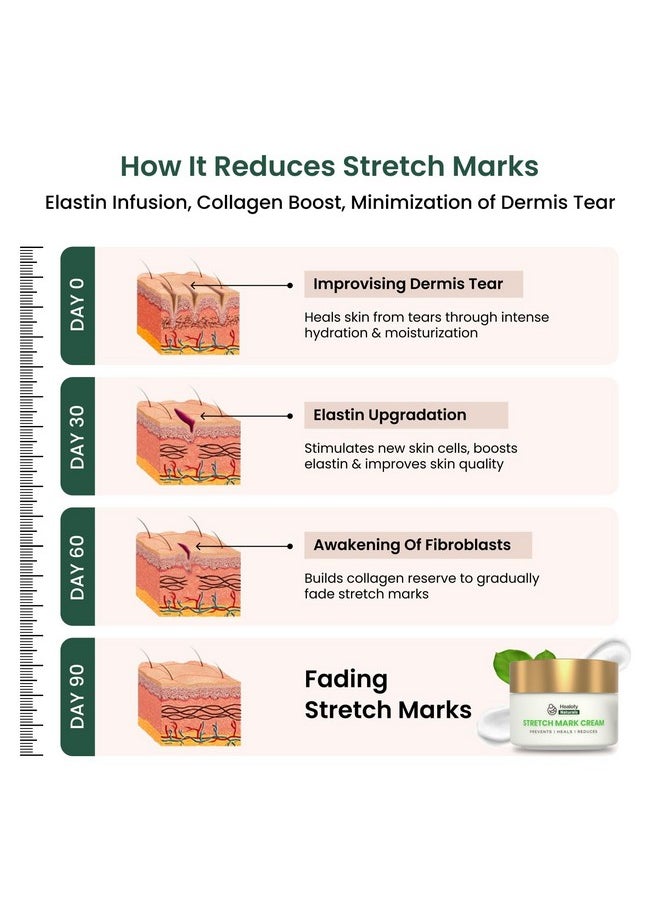Healofy Naturals - Healofy Stretch Marks Cream - Advanced Stretch Mark Removal Cream | Reduces Stretch Marks & Scars |Visible Results In 28 Days | Hydrates, Heals & Rejuvenates Skin | Safe Oil & Butter Blend (Shea, Cocoa, Jojoba, Coconut) | Best Stretch Mark Prevention During Pregnancy | 100 Grams | Pack Of 3 - Image 1