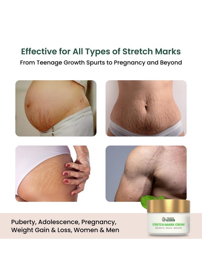 Healofy Naturals - Healofy Stretch Marks Cream - Advanced Stretch Mark Removal Cream | Reduces Stretch Marks & Scars |Visible Results In 28 Days | Hydrates, Heals & Rejuvenates Skin | Safe Oil & Butter Blend (Shea, Cocoa, Jojoba, Coconut) | Best Stretch Mark Prevention During Pregnancy | 100 Grams | Pack Of 3 - Image 1