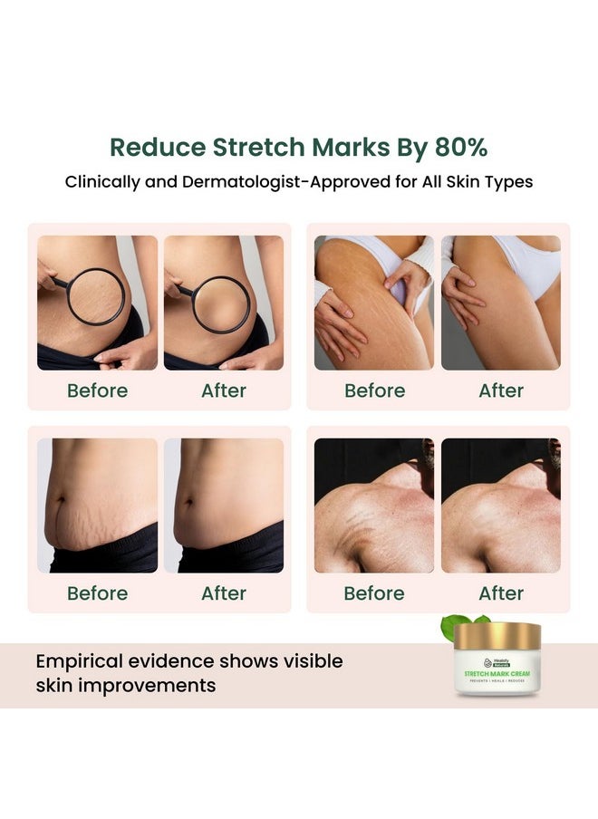 Healofy Naturals - Healofy Stretch Marks Cream - Advanced Stretch Mark Removal Cream | Reduces Stretch Marks & Scars |Visible Results In 28 Days | Hydrates, Heals & Rejuvenates Skin | Safe Oil & Butter Blend (Shea, Cocoa, Jojoba, Coconut) | Best Stretch Mark Prevention During Pregnancy | 100 Grams | Pack Of 3 - Image 1