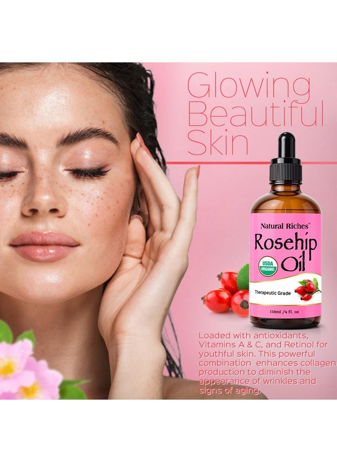Natural Riches - Natural Riches Organic Rosehip Seed Oil for Face 100% Pure Natural Cold Pressed Unrefined Non-GMO Carrier Oil for Skin Hair & Nails. 4 fl oz. - Image 1