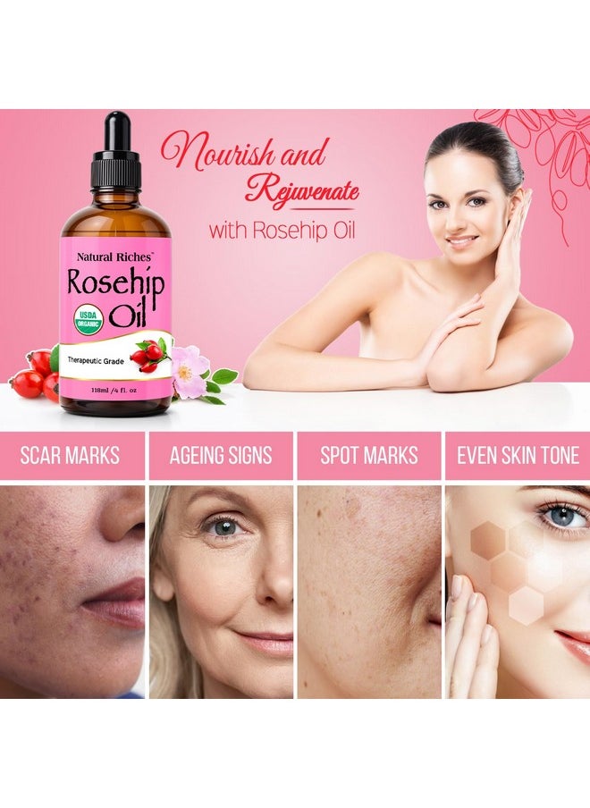 Natural Riches - Natural Riches Organic Rosehip Seed Oil for Face 100% Pure Natural Cold Pressed Unrefined Non-GMO Carrier Oil for Skin Hair & Nails. 4 fl oz. - Image 1