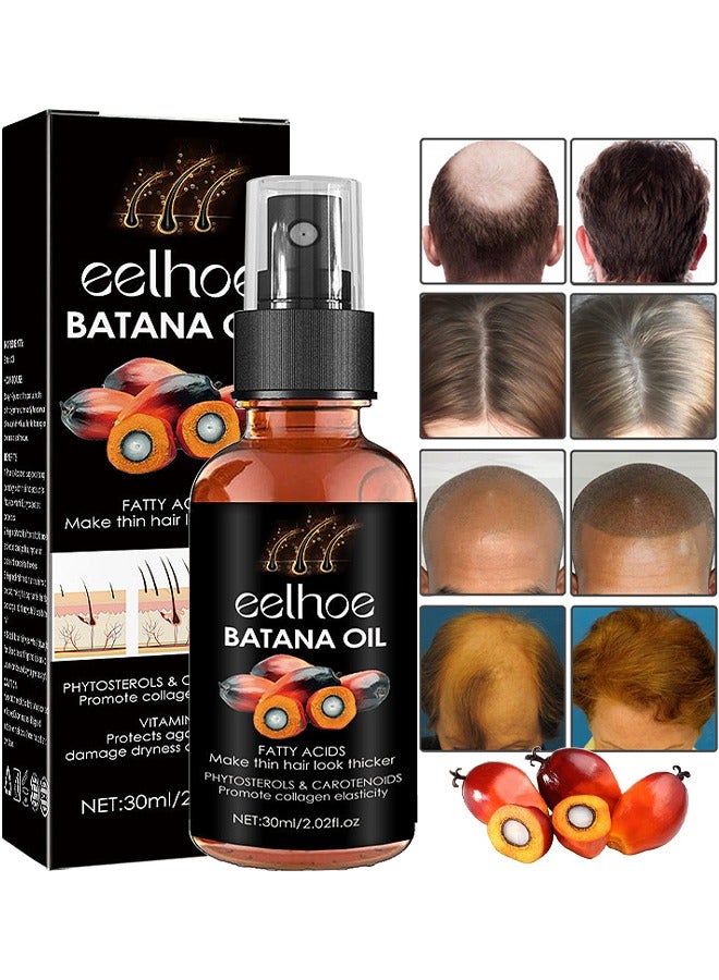 EELHOE Batana Oil For Hair Growth, Batana Oil Organic For Healthy Hair, Repair Damaged Hair, Nourishes Thin Hair Scalp Skin And Loss Hair Growth Fir, Reduces Hair Loss, 30ML - Image 1
