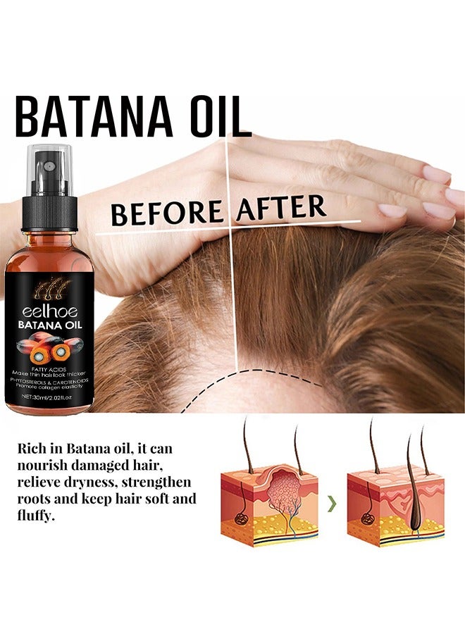EELHOE Batana Oil For Hair Growth, Batana Oil Organic For Healthy Hair, Repair Damaged Hair, Nourishes Thin Hair Scalp Skin And Loss Hair Growth Fir, Reduces Hair Loss, 30ML - Image 4