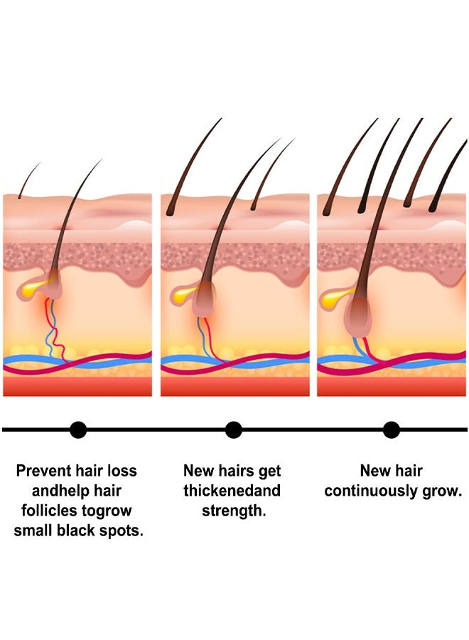 EELHOE Batana Oil For Hair Growth, Batana Oil Organic For Healthy Hair, Repair Damaged Hair, Nourishes Thin Hair Scalp Skin And Loss Hair Growth Fir, Reduces Hair Loss, 30ML - Image 5