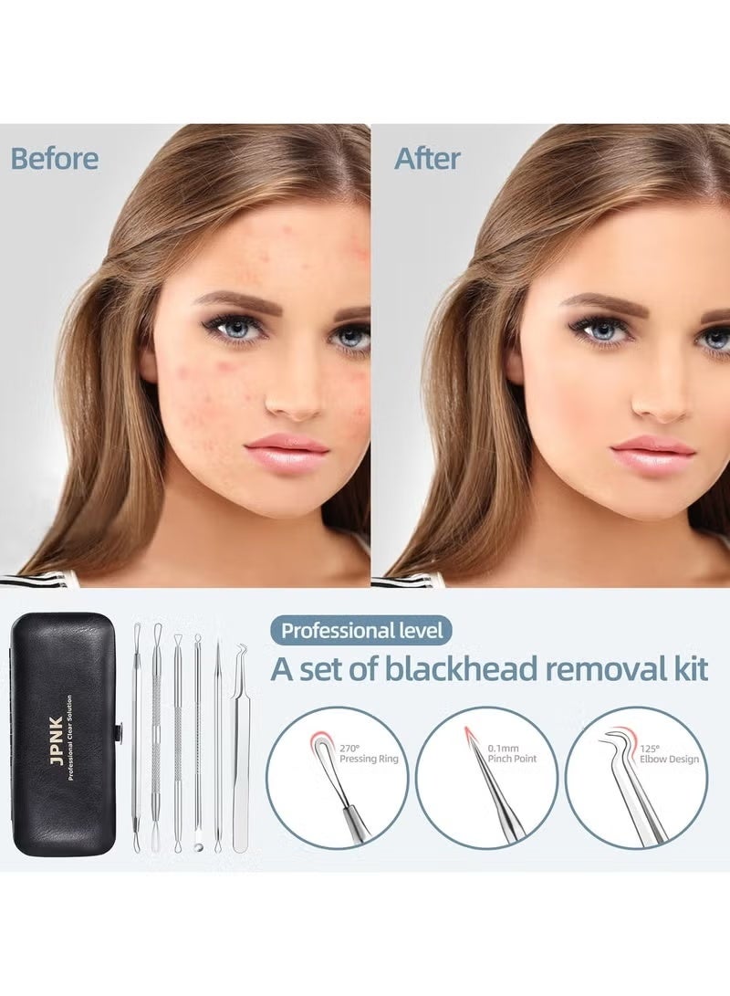 مجموعة أدوات إزالة الرؤوس السوداء، مستخرج الرؤوس السوداء، مجموعة إزالة حب الشباب، لإزالة البثور والرؤوس البيضاء، 6 قطع لإزالة البثور من الأنف والوجه مع حقيبة جلدية - Image 2