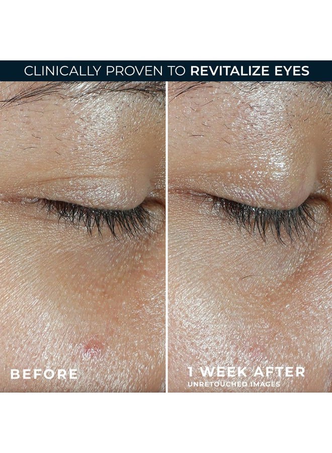 RoC بلسم العين فيتامين سي متعدد التصحيح + الإشراقة (0.14 أونصة) مع عبوة كريم العين ريتينول - Image 4