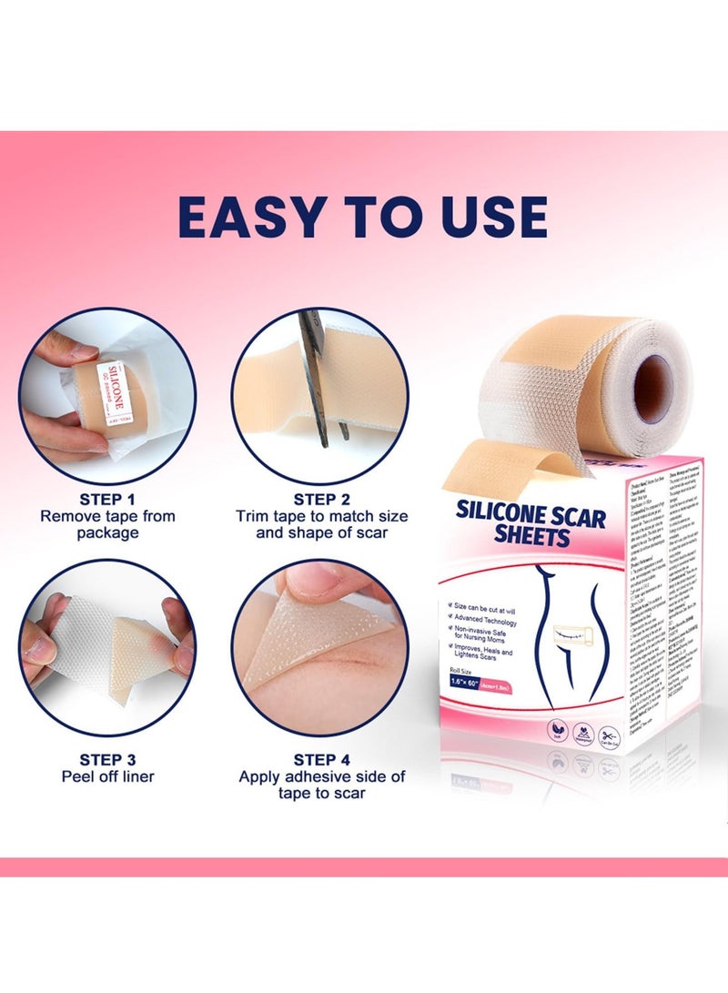 Bukela Silicone Scar Sheets (4cm*1.5m), Medical Grade Soft Silicone Scar Tape Roll, Reusable Scar Silicone Strips, Professional Scar Removal Sheets for C-Section, Surgery, Burn, Keloid, Acne - Image 2