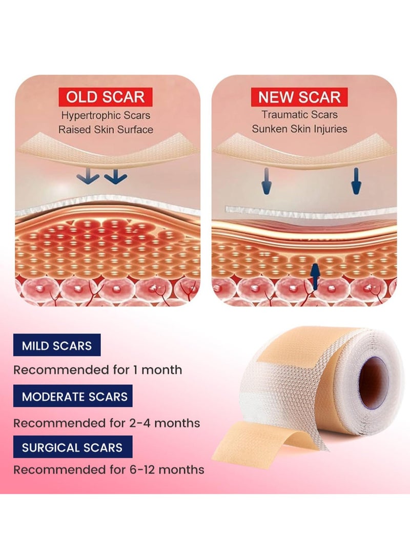 Bukela Silicone Scar Sheets (4cm*1.5m), Medical Grade Soft Silicone Scar Tape Roll, Reusable Scar Silicone Strips, Professional Scar Removal Sheets for C-Section, Surgery, Burn, Keloid, Acne - Image 5