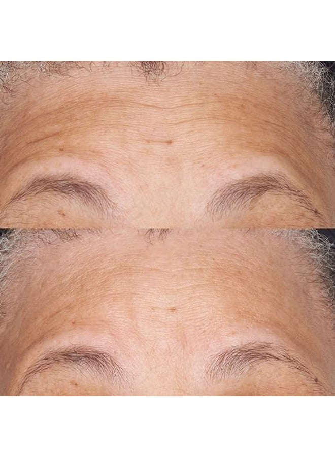 Perricone MD Hypoallergenic Clean Correction Barrier Repair Moisturizer 2 Fl. Oz. - Image 4