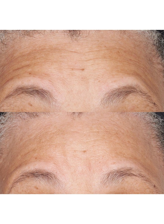 Perricone MD Hypoallergenic Clean Correction Barrier Repair Moisturizer 2 Fl. Oz. - Image 3