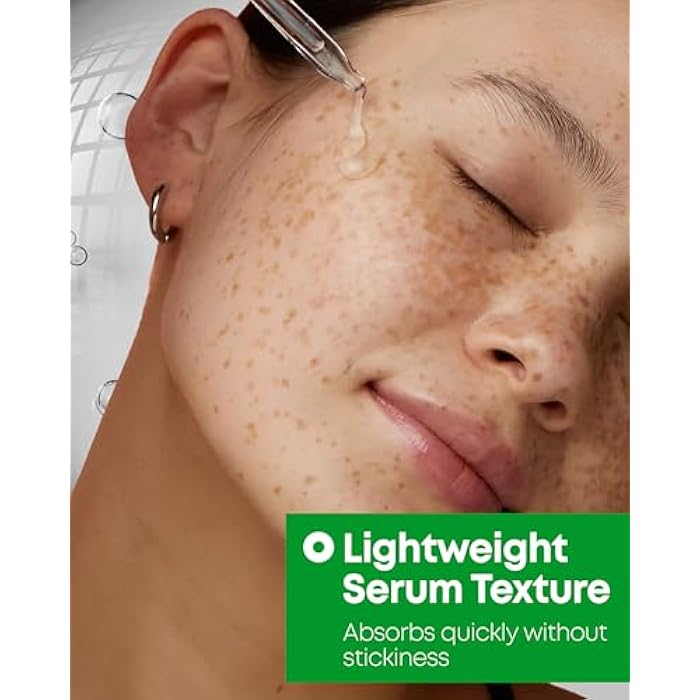 NINELESS A-Control 10% Azelaic Acid Serum - Korean Acne Serum for Face - Calming Facial Treatment Clearing Breakout, Pimples - for Acne-Prone & Dull Skin, 1.01 fl.oz. - Image 4