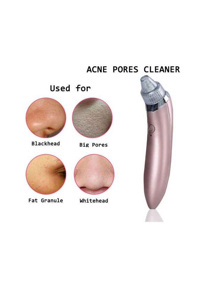 Generic 4-In-1 Blackhead Remover Device Rose Gold/Clear - Image 1