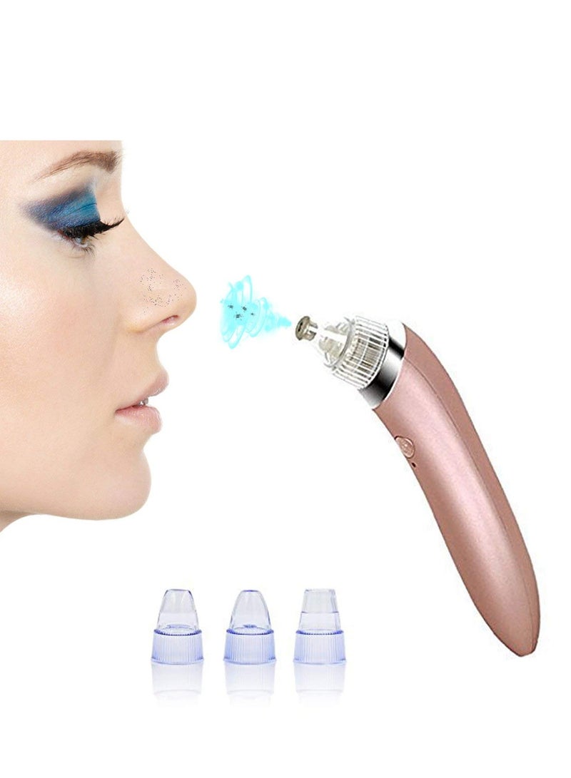 Generic 4-In-1 Blackhead Remover Device Rose Gold/Clear - Image 2