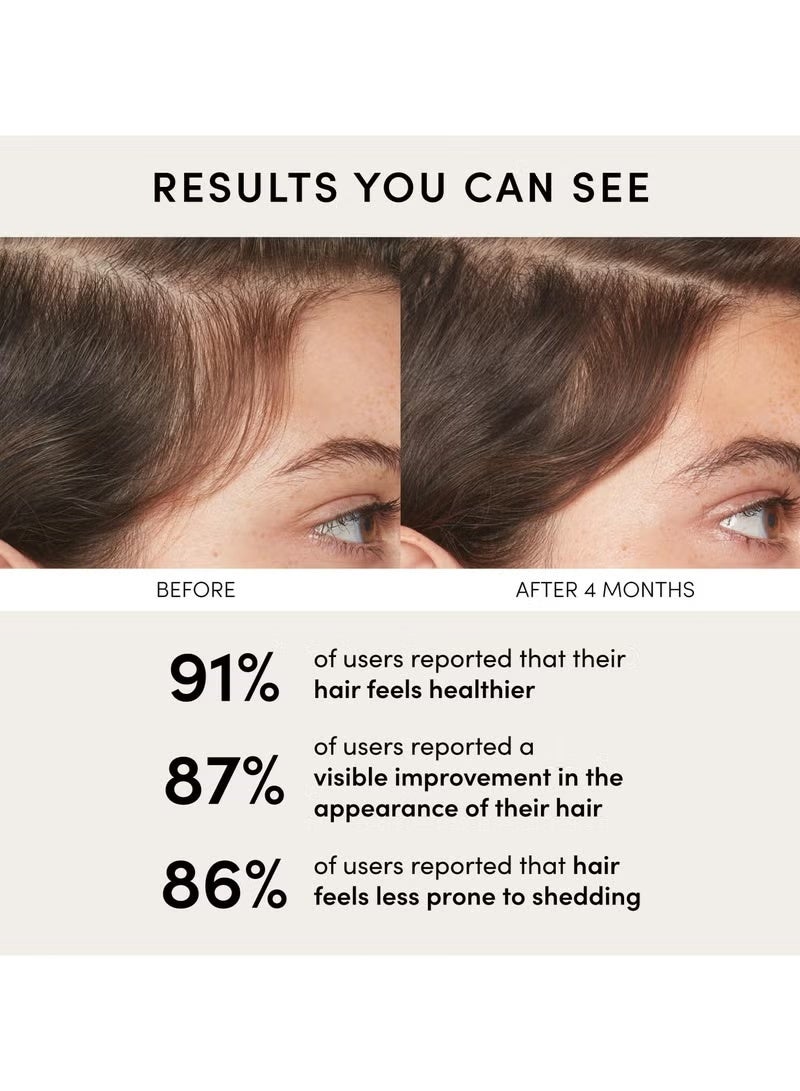 Ouai Scalp Serum - Balancing Hair Serum with Red Clover Extract, Siberian Ginseng and Peptides for Thicker and Fuller-Looking Hair - Paraben, Phthalate and Sulfate Free Scalp Care (2 Fl Oz) - Image 5