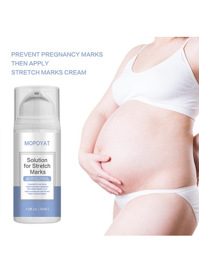 MOPOYAT postpartum stretch mark cream  - Image 3