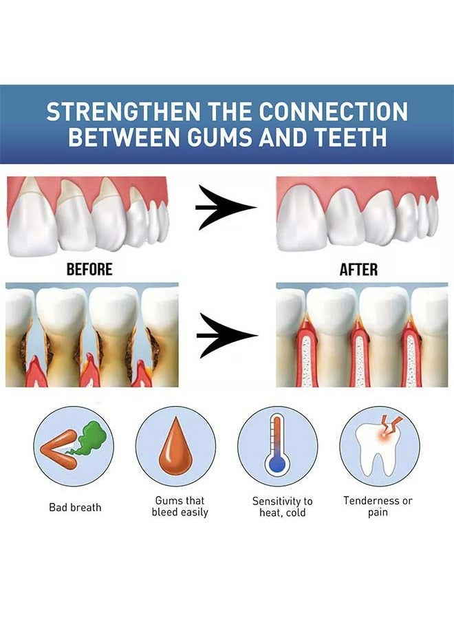 West&Month - Gum Instant Soothing Gel 4ml, Relieve Gum Recession/Swelling/Pain, Whitening Gum Care Gel for Cleaning Plaque Stains - Image 1