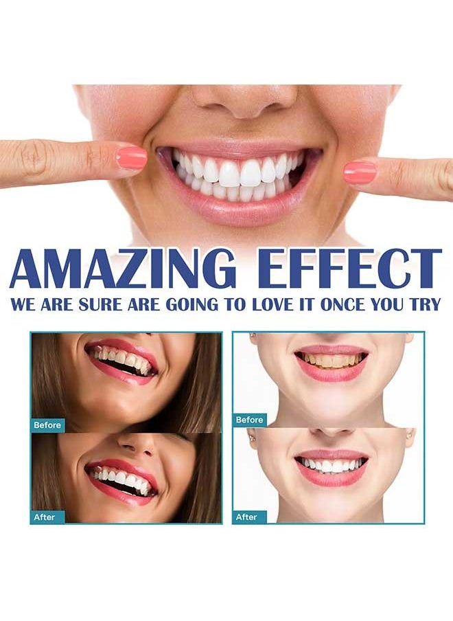West&Month - Gum Instant Soothing Gel 4ml, Relieve Gum Recession/Swelling/Pain, Whitening Gum Care Gel for Cleaning Plaque Stains - Image 1