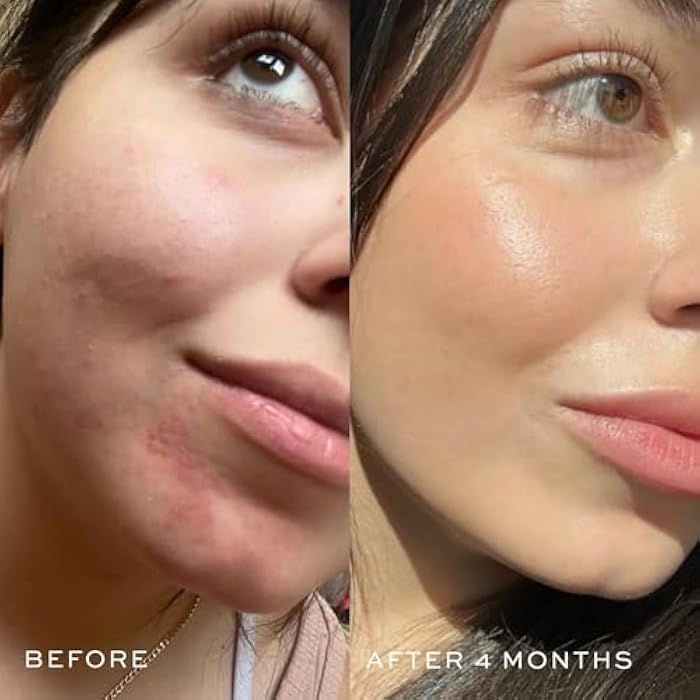 DIME Beauty Blue Facial Oil, 1 oz / 30 mL - Blemish Spot Treatment with Blue Tansy, Black Cumin Seed, Rosehip, and Grapeseed Oils - Image 3