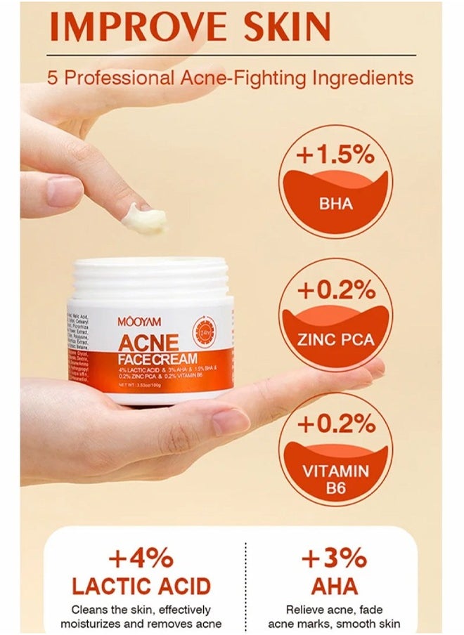 Acne Face Cream-Lactic Acid Treatment Cream Acne AHA Face Cream Anti-Acne Moisturizer 30g