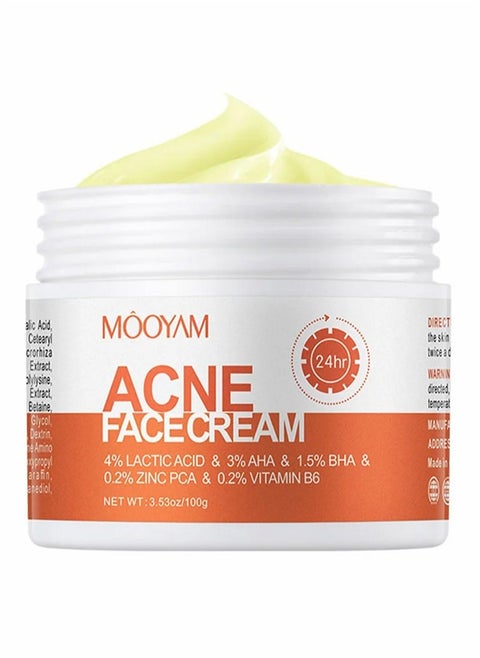 Acne Face Cream-Lactic Acid Treatment Cream Acne AHA Face Cream Anti-Acne Moisturizer 30g