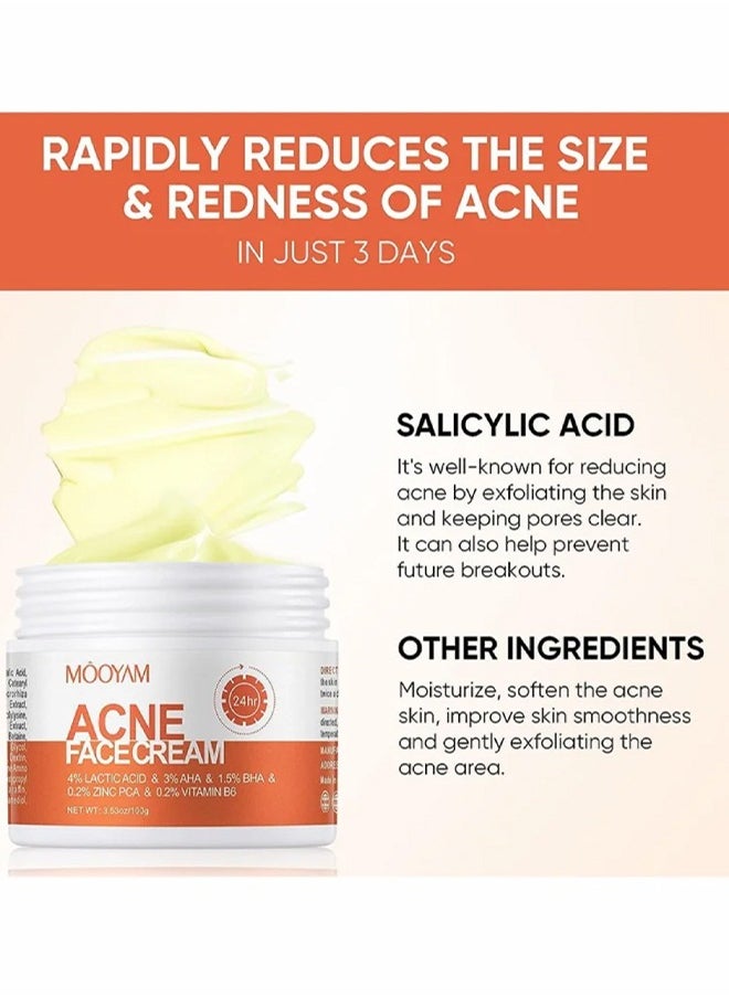 Acne Face Cream-Lactic Acid Treatment Cream Acne AHA Face Cream Anti-Acne Moisturizer 30g
