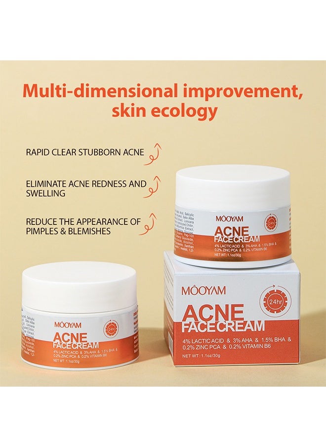 Acne Face Cream-Lactic Acid Treatment Cream Acne AHA Face Cream Anti-Acne Moisturizer 30g