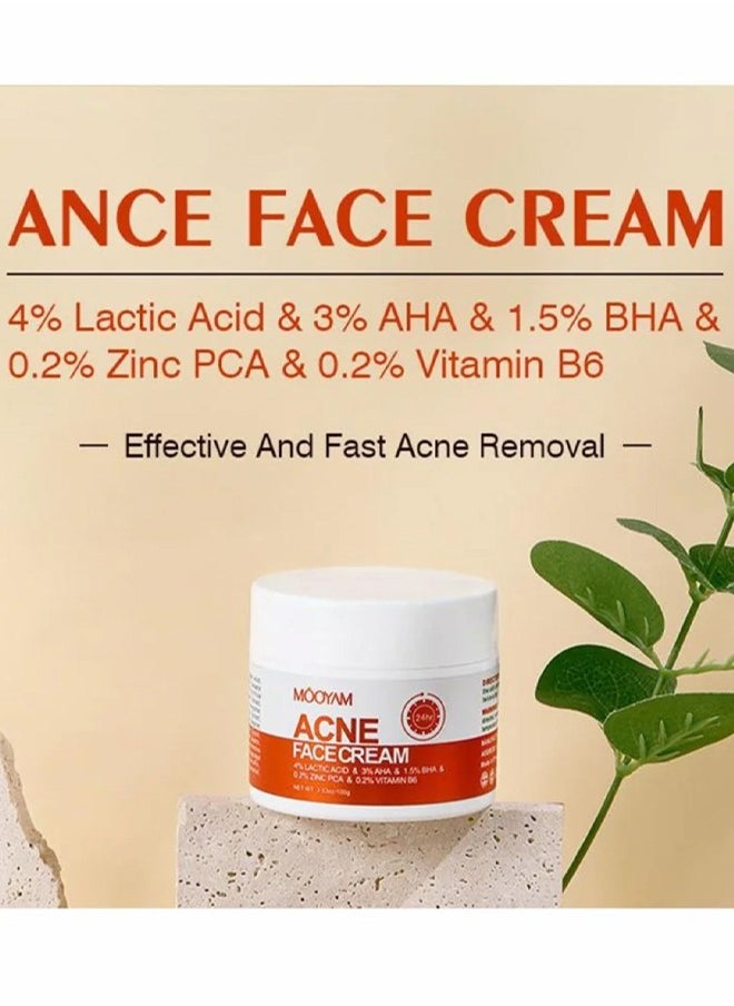 Acne Face Cream-Lactic Acid Treatment Cream Acne AHA Face Cream Anti-Acne Moisturizer 30g