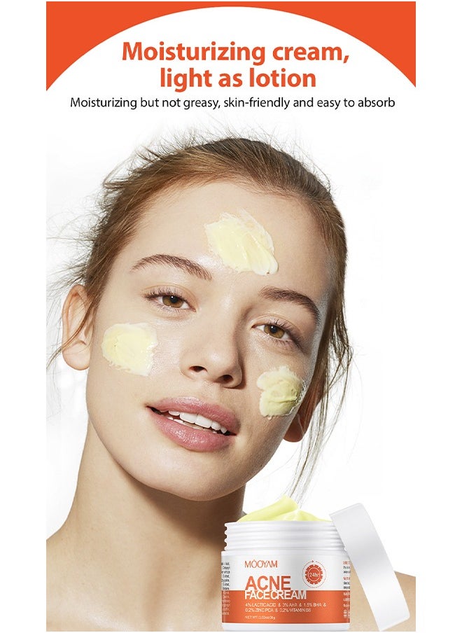 Acne Face Cream-Lactic Acid Treatment Cream Acne AHA Face Cream Anti-Acne Moisturizer 30g