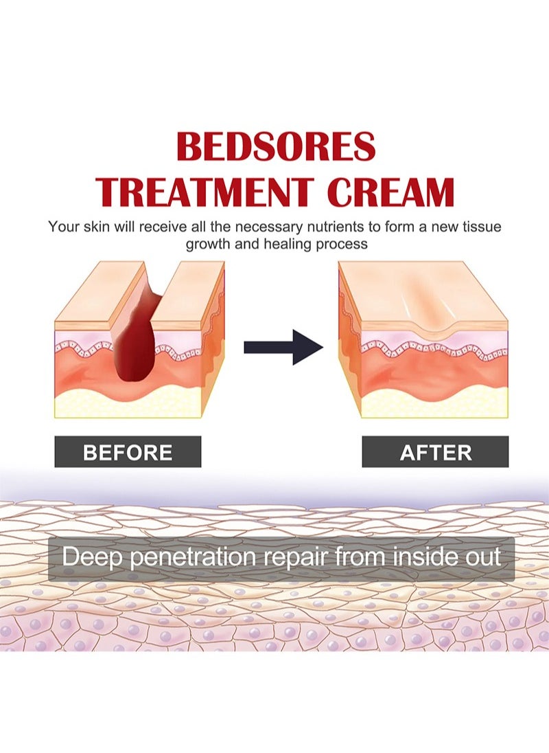EELHOE - Decubitus Repair Cream，Bedsores Treatment Cream-Rapid Healing of Bedsores and Pressure Ulcers，Deep Penetration Soothing Natural Moisturizing Cream，Easy to Apply Sore Relief - Image 1