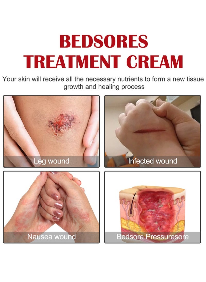 EELHOE - Decubitus Repair Cream，Bedsores Treatment Cream-Rapid Healing of Bedsores and Pressure Ulcers，Deep Penetration Soothing Natural Moisturizing Cream，Easy to Apply Sore Relief - Image 1
