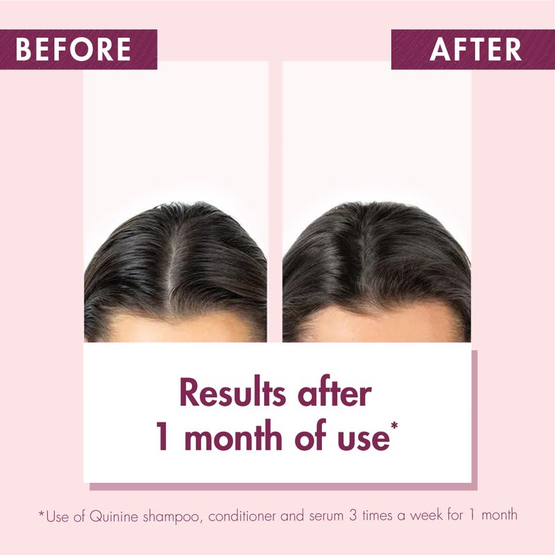 Klorane - Strengthening Shampoo - with Quinine & Edelweiss For Thinning Hair - Support Thicker Hair - Silicone, Paraben & Sulfate Free - 13.5 fl. oz. - Image 4