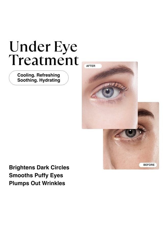 MATKAS - Gold Under Eye Patches - 0.05% Pure Retinol + Hyaluronic Acid + Collagen for Dark Circles, Wrinkles, and Puffy Eyes, Under Eye Mask Puffiness Treatment for Women, Under Eye Gel Pads, Bag Patch - Image 1