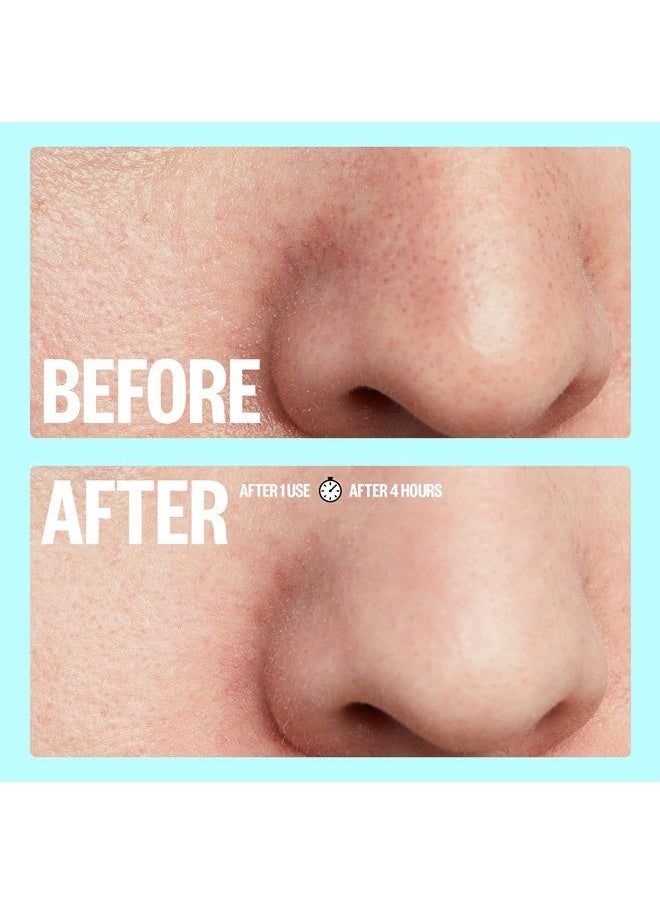 PEACE OUT - Skincare Pores. Hydrocolloid Pore-Refining Nose and Face Strips with Vitamin A to Shrink Enlarged Pores and Remove Excess Oil (4 pore and 4 nose strips) - Image 1