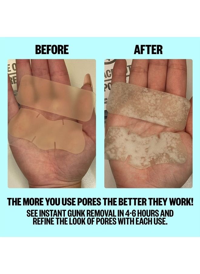 PEACE OUT - Skincare Pores. Hydrocolloid Pore-Refining Nose and Face Strips with Vitamin A to Shrink Enlarged Pores and Remove Excess Oil (4 pore and 4 nose strips) - Image 1