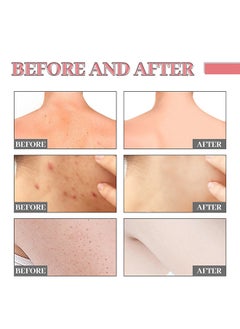 Jaysuing Vitalizing Salicylic Acid Scrub Soap, Pore Exfoliating, Softening Skin, Anti-blemishes, Removing Acne, Exfoliating, Desalting Acne Mark Moisturizing Skin Cleansing Soap Shower Soap  - Image 4