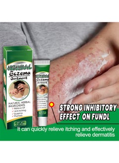 EELHOE Treatment Psoriasis Eczema Cream Antibacterial Antipruritic Dermatitis Herbal Ointment Anti-itch Medical Plaster  - Image 3