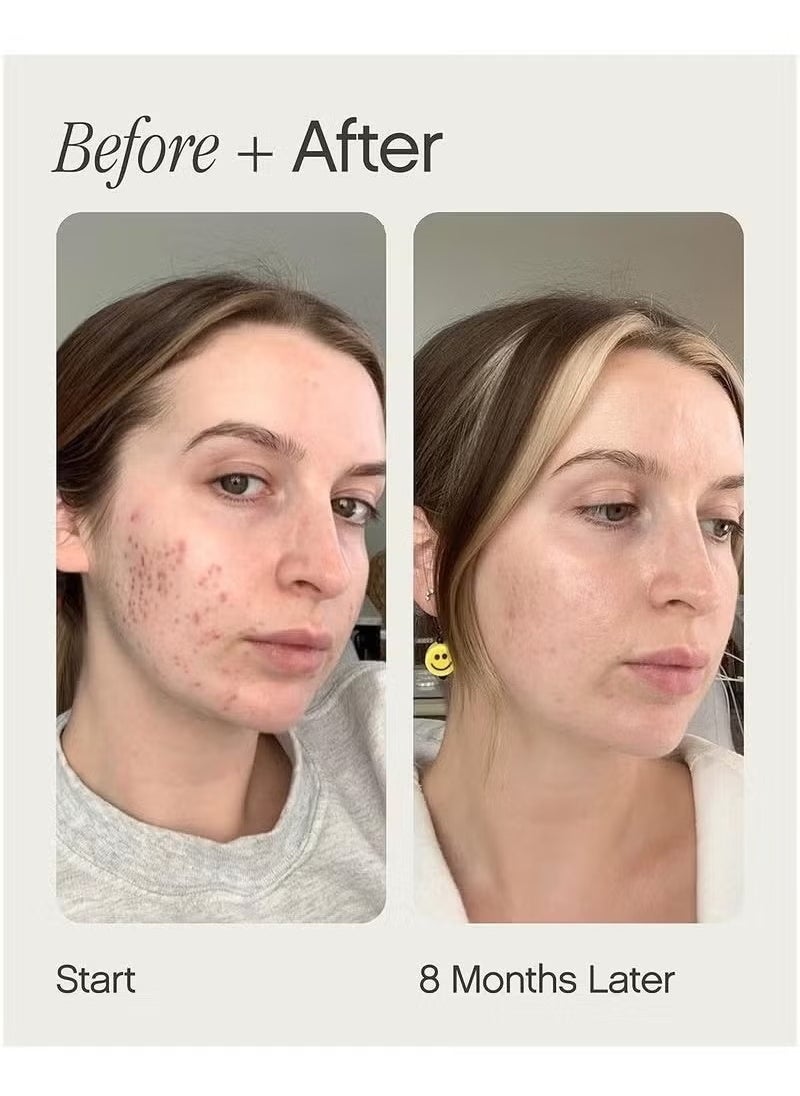 TOPICALS Faded Brightening and Clearing Serum | Reduces Discoloration Post-Blemish Marks Scars Spots Contains Kojic Acid Niacinamide Dermatologist-tested Vegan Cruelty-Free Fl Oz  - Image 4