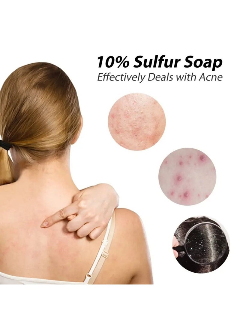 Skin Doctor Skin Doctor Sulfur Soap (80G) Deep Cleansing & Acne Treatment Soap For Clear Skin  - Image 5