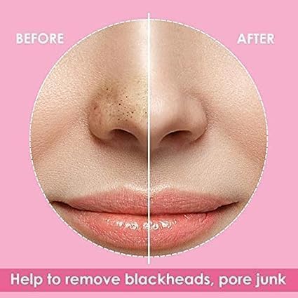 Generic Blackhead Pore Strips Nose Strips for Black Head RemoverDeep Cleansing Charcoal Strips with Instant Blackhead Removal  - Image 3