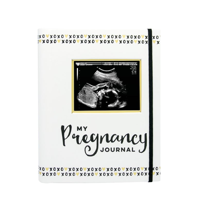 Pearhead My Pregnancy Journal - 74-Page Memory Book and Photo Album, Gender Neutral Planner for Expecting Moms, Includes Milestone Sections and Ultrasound Photo Insert - Image 1