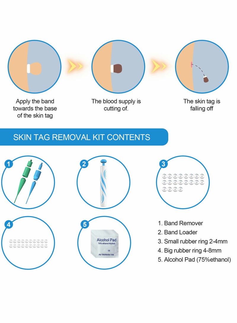 Generic - Skin Tag Remover,Painless Remover Pen,Skin Removal Kit Tools with 40 Micro and Regular Bands,Easy Device to Remove (2mm-8mm) - Image 1
