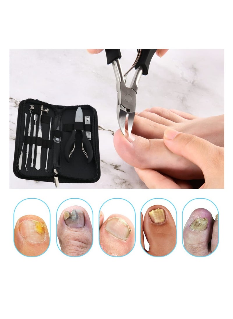 Bcabo 10Pcs/set Ingrown Toenail Tools Kit, Nail Treatment Foot Tool,Ingrown Toenail Removal Correction Clippers, Surgery Grade Nail File Lifter, Professional Pedicure Tool - Image 2