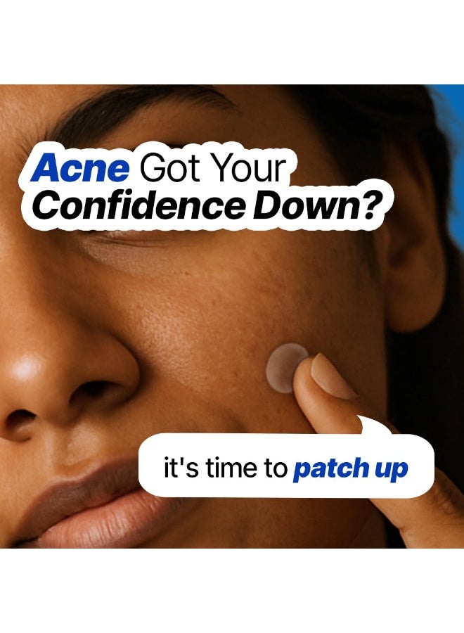 So True Sotrue Acne Pimple Patches For Face | For Active Surface Acne | Hydrocolloid Waterproof Patches | Absorbs Pimple Overnight, Reduces Excess Oil | Suits All Skin Types (54 Patches) - Image 2