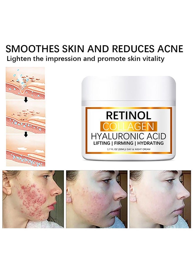LANEMAY - Retinol Collagen Hyaluronic Acid，Cream for Face, Anti-Aging Moisturizer with Hyaluronic Acid & Vitamin E, Collagen Cream for Wrinkles & Dark Spots, Night Cream for Youthful Skin (50g) - Image 1