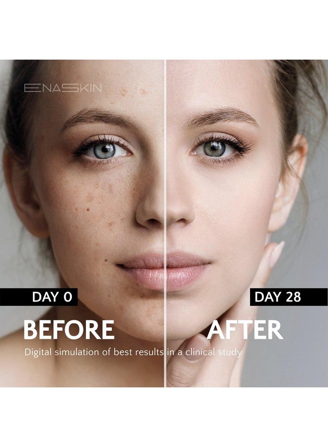 EnaSkin Dark Spot Remover For Face And Body: Age Spot Sun Spot Freckles Melasma Brown Spot Serum - Advanced Formula Corrector Cream With Niacinamide For Women And Men (1.0 Fl Oz) - Image 3