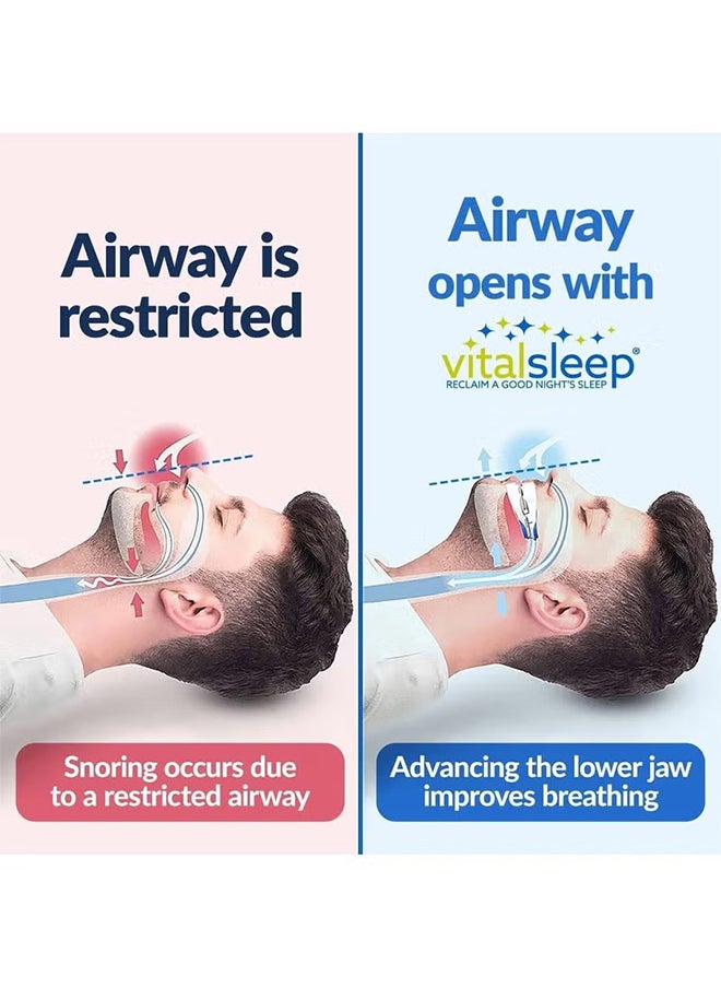 VINSOC - Anti-snoring Device Mouthpiece Upgraded Adjustable Mouth Type Silicone Anti-snoring Device Help Sleep at Night Prevent Snoring and Snoring Anti-grinding Braces Snoring Device Standard Size - Image 1