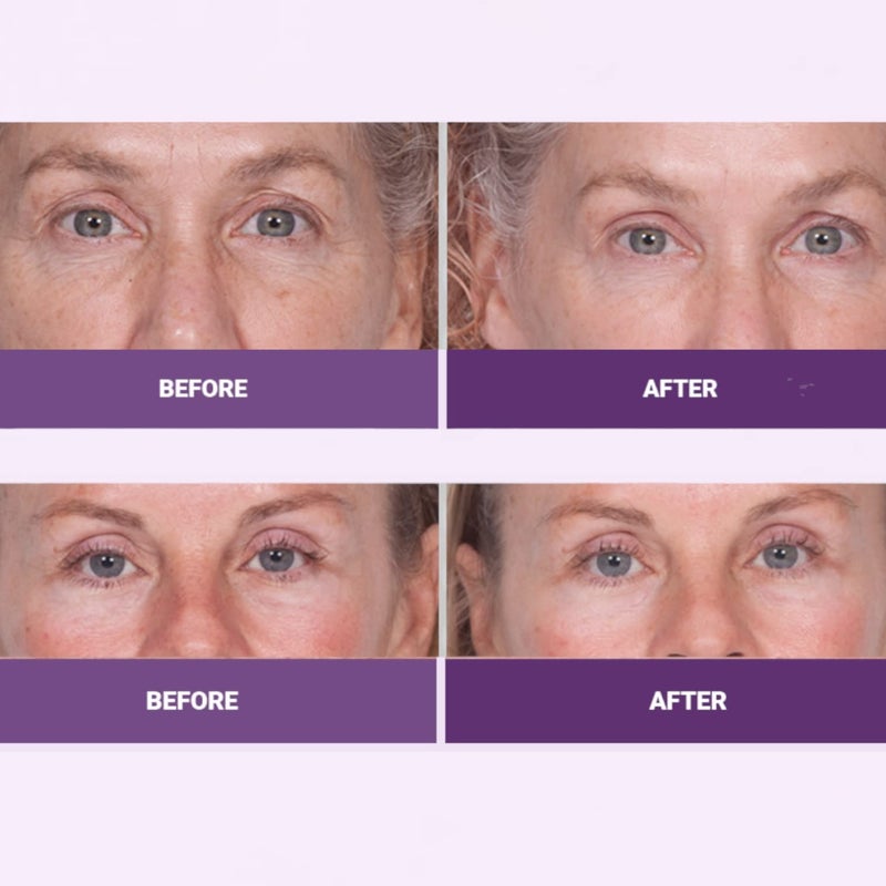 Serious Skincare INSTA-TOX Facial Firming Wrinkle Smoothing Serum & Reverse Lift Firming Eye Cream Set - Tightener for Lines, Deep Wrinkles and Pores - Temporary Lift for Face and Eyes - Serious Skincare - Image 4